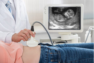 Frauenarztpraxis Marienheide Dr. Aleksandrow - Ultraschalluntersuchung, Sonographie, NIPT